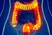 این علائم می گوید روده شما ناسالم است