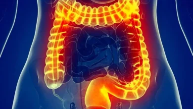 این علائم می گوید روده شما ناسالم است