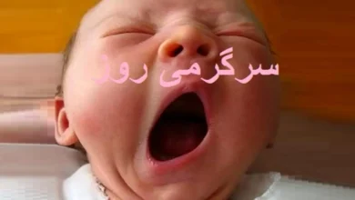 هشدار جدی/اگر در طول روز بیشتر از این مقدار خمیازه می کشید به این بیماری دچاری